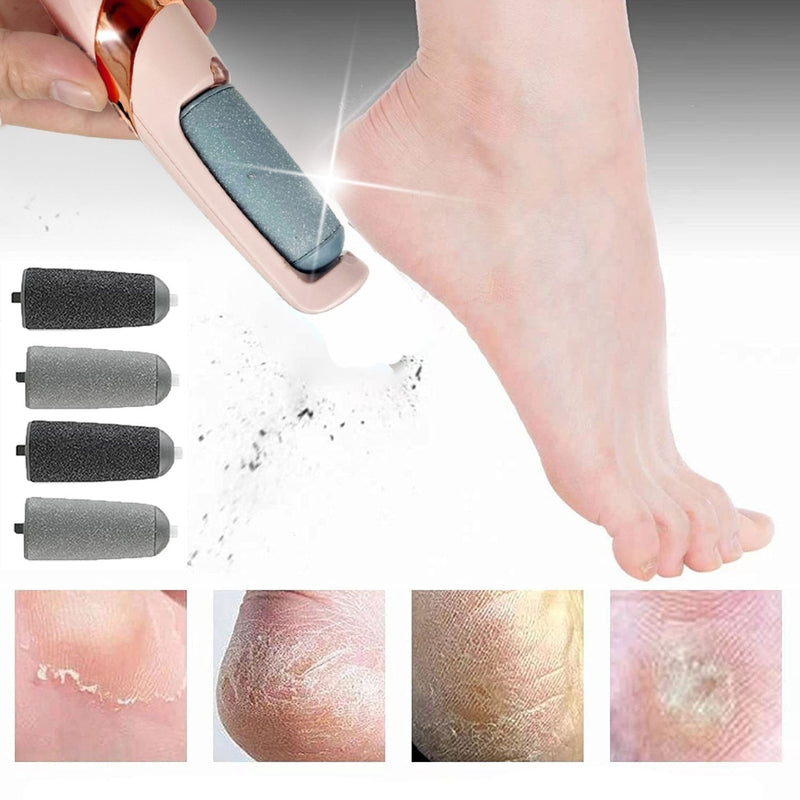 Soft Feet - Foot Crack Remover